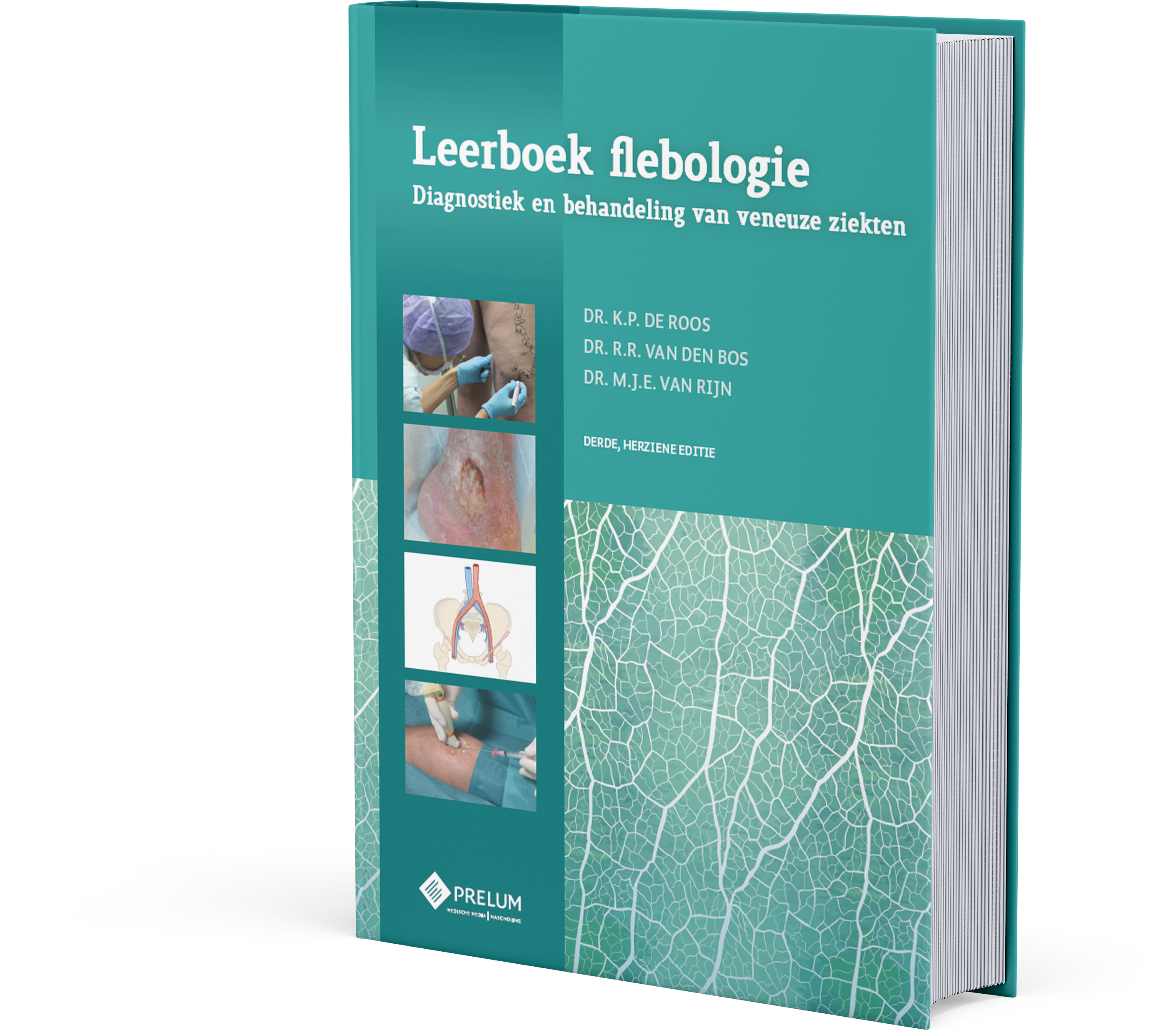 Leerboek flebologie cover